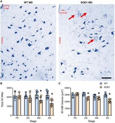Timeline of hypoglossal motor neuron death and intrinsic tongue muscle denervation in high-copy number SOD1G93A mice